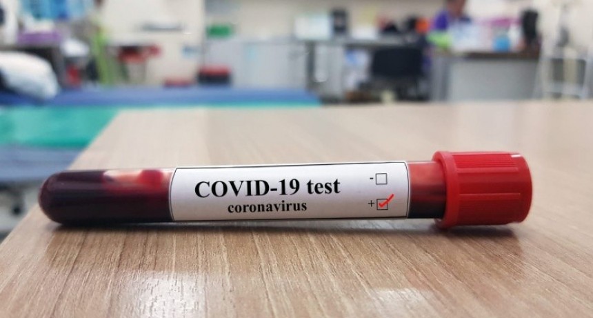 TUCUMÁN Y UN NUEVO CASO DE CORONAVIRUS